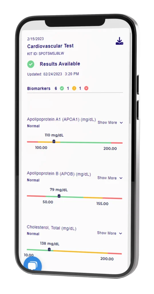 cardiovascular test results on mobile screen